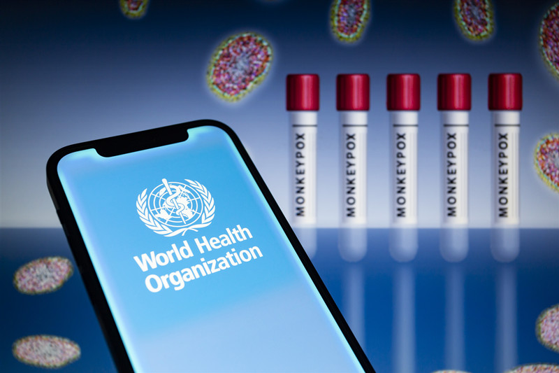 A medida que la viruela del mono se propaga, ?Occidente ha aprendido alguna lección del COVID-19?